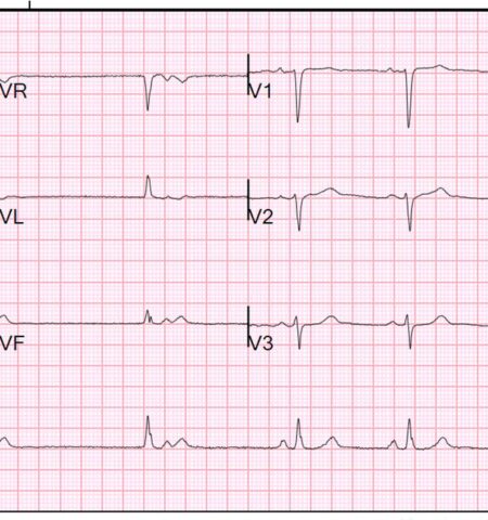 EKG Course